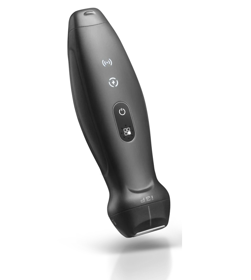 Ultralydsscanner TE Air.1